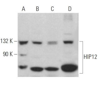 HIP12 Antibody (1C5) - Western Blotting - Image 379342 