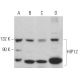HIP12 Antibody (1C5) - Western Blotting - Image 379342 
