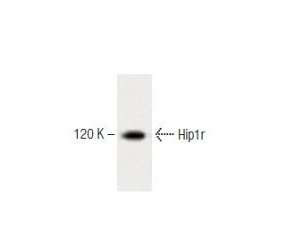 Hip1r Antibody (44) - Western Blotting - Image 60308 