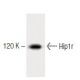 Hip1r Antibody (44) - Western Blotting - Image 60308 