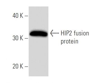 HIP2 Antibody (757C3a) - Western Blotting - Image 16921