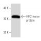HIP2 Antibody (757C3a) - Western Blotting - Image 16921
