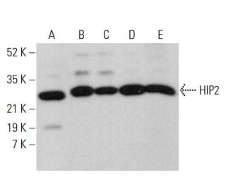 HIP2 Antibody (C-5) - Western Blotting - Image 377388 