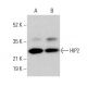 HIP2 Antibody (C-5) - Western Blotting - Image 377395 