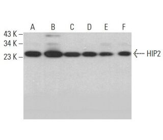 HIP2 Antibody (H-6) - Western Blotting - Image 381373 