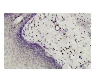 immunohistochemistry image from recommended HIPK2 (F-189) monoclonal antibody replacement. Image 35997
