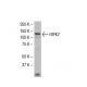HIPK2 Antibody (F-189) - Western Blotting - Image 33759