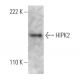HIPK2 Antibody (F-189) - Western Blotting - Image 368225 
