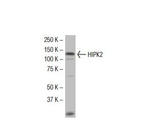 HIPK2 Antibody (F-189) - Western Blotting - Image 33759The Double Nickase Plasmid features a U6 promoter for sgRNA expression, a 20 nt targeting sequence, and a gRNA scaffold to guide Cas9n. It includes a CBh promoter for Cas9n (D10A) and puromycin resistance, GFP for transfection verification, and nuclear localization signals (NLS). The 2A peptide allows co-expression of Cas9n and Puro from a single promoter, enabling precise genome editing with reduced off-target effects.