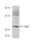 Hippi Antibody (JA52) - Western Blotting - Image 53956
