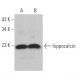 hippocalcin Antibody (G-8) - Western Blotting - Image 367175