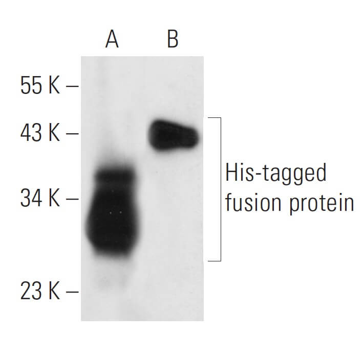 His Tag Antibody AD1.1.10 SCBT Santa Cruz Biotechnology