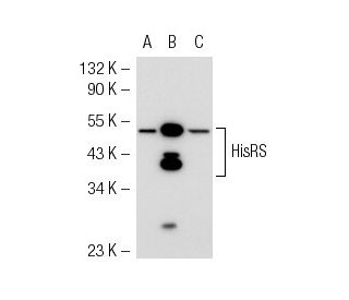 HisRS Antibody (HARSA6) - Western Blotting - Image 54267 