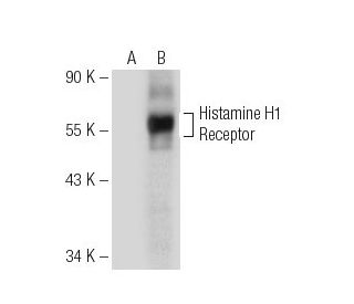 Histamine H1 Receptor Antibody (G-11) - Western Blotting - Image 153893SAM Transcription Activation: SAM system utilizing dCas9-VP64, MS2-P65-HSF1, and sgRNA for precise gene transcription activation. 