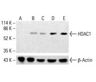 Histone Deacetylase 1 (HDAC1) Antibody (10E2) - Western Blotting - Image 412714