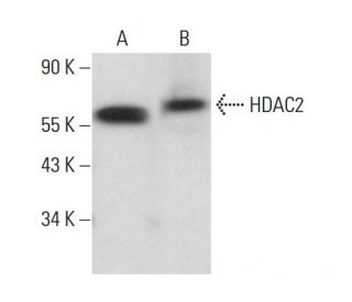 Histone Deacetylase 2 (HDAC2) Antibody (3F3) - Western Blotting - Image 380247