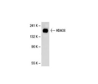 Histone Deacetylase 6 (HDAC6) Antibody (D-11) - Western Blotting - Image 22184