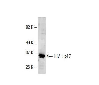 HIV-1 p17 Antibody (17-1) - Western Blotting - Image 38346