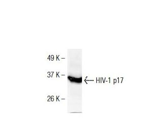HIV-1 p17 Antibody (17-3) - Western Blotting - Image 38347
