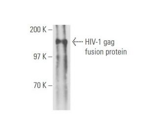 HIV-1 p24 Antibody (24-2) - Western Blotting - Image 57818