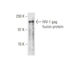 HIV-1 p24 Antibody (24-3) - Western Blotting - Image 57819