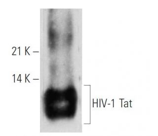 HIV-1 Tat Antibody (02-001) - Western Blotting - Image 19285