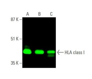HLA class I Antibody (HP-1F7) - Western Blotting - Image 378868 
