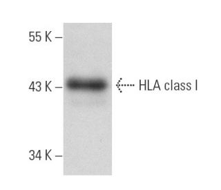 HLA class I Antibody (YTH862.2) - Western Blotting - Image 19283 