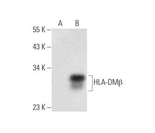HLA-DM&beta; Antibody (E-8) - Western Blotting - Image 296272Each CRISPR/Cas9 Knockout (KO) Plasmid product consists of a pool of 3 plasmids designed to ensure identification and cleavage of a specific gene for maximum knockout efficiency. Each plasmid encodes a unique 20 nt sequence derived from the GeCKO (v2) library. 