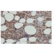 HLA-DMα Antibody (NB-B33) - Immunohistochemistry - Image 64959