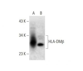 HLA-DM&beta; Antibody (E-8) - Western Blotting - Image 297845 