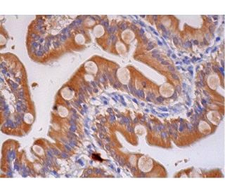 HLA-DO&beta; Antibody (DOB.L1) - Immunohistochemistry - Image 293294 