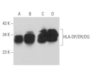HLA-DP/DR/DQ Antibody (PdV5.2) - Western Blotting - Image 357683 