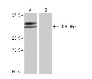 HLA-DP&alpha;1 Antibody (NB-A3) - Western Blotting - Image 64963