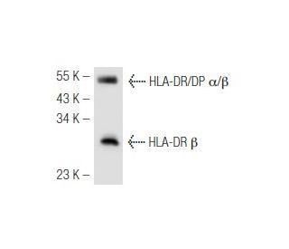 HLA-DR Antibody (520B) - Western Blotting - Image 47667 