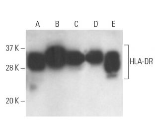 HLA-DR Antibody (Bra22) - Western Blotting - Image 10977 
