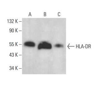 HLA-DR Antibody (TAL 15.1) - Western Blotting - Image 378522 