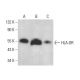 HLA-DR Antibody (TAL 15.1) - Western Blotting - Image 378522 