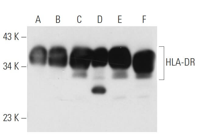 HLA-DR抗体(TAL 1B5) | SCBT - Santa Cruz Biotechnology