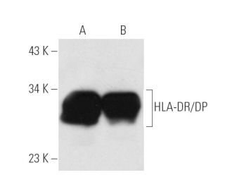 HLA-DR/DP Antibody (HL-38) - Western Blotting - Image 14002 