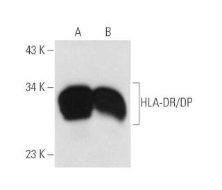 HLA-DR/DP Antibody (HL-40) - Western Blotting - Image 14003 