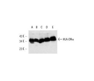 HLA-DR&alpha; Antibody (DA6.147) - Western Blotting - Image 12721 