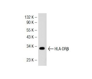 HLA-DR&beta; Antibody (TDR 31.1) - Western Blotting - Image 33034 