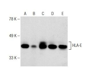 HLA-E Antibody (3H2679) - Western Blotting - Image 149071 