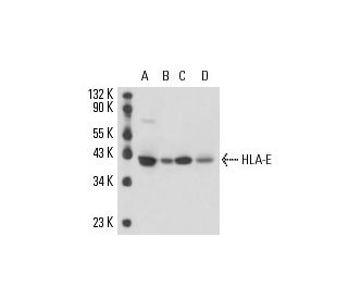 HLA-E Antibody (MEM-E/08) - Western Blotting - Image 16136