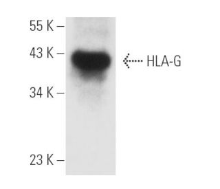HLA-G Antibody (4H84) - Western Blotting - Image 6215 