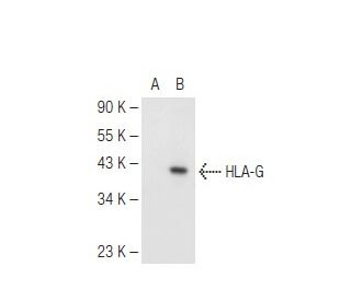 HLA-G Antibody (6D463) - Western Blotting - Image 82429