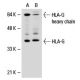 HLA-G Antibody (MEM-G/1) - Western Blotting - Image 18517 