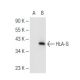 HLA-G Antibody (MEM-G/1) - Western Blotting - Image 82431