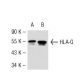 HLA-G Antibody (MEM-G/2) - Western Blotting - Image 52828 